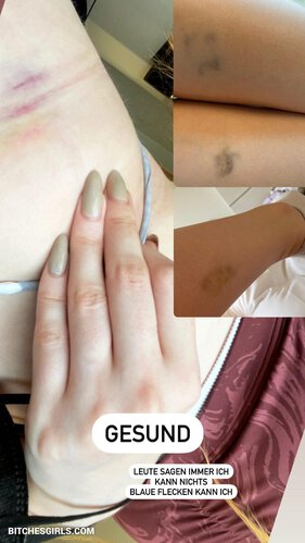 Kdrkitten Nude Twitch - Leaked Nude Photo